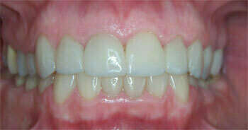 Cas du mois de Novembre 2017