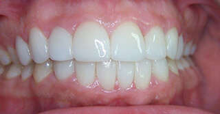 Cas de décembre 2018