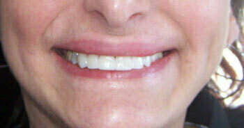 Cas du mois d'Avril 2018