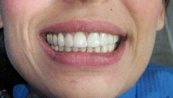 Cas du mois de Septembre 2018