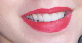 Cas de Novembre 2018