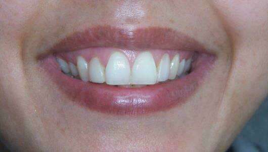 Cas du mois de Juin 2018