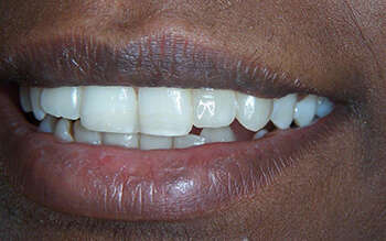 Cas du mois de Décembre 2017