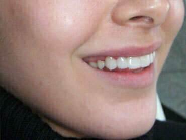 Cas du mois d'octobre 2017