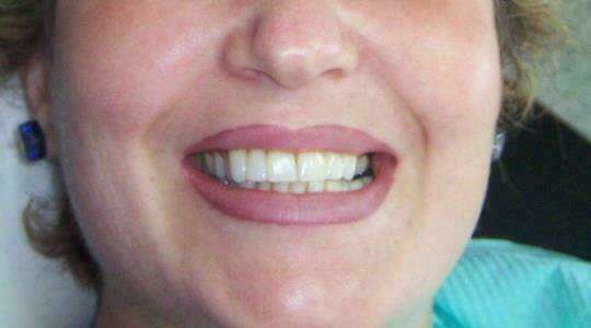 Cas du mois de Septembre 2017