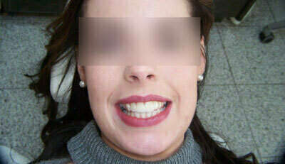 Cas du mois d'Avril 2017