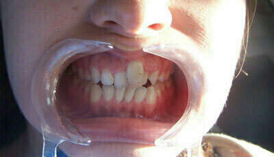 Cas du mois de janvier 2017