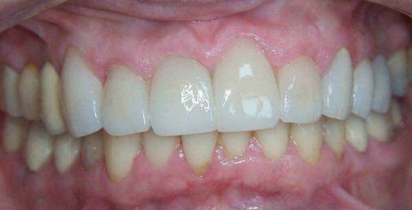 Cas du mois de juin 2016