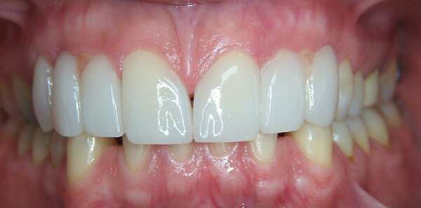 Cas du mois de mai 2016