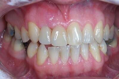 Cas du mois de février 2016