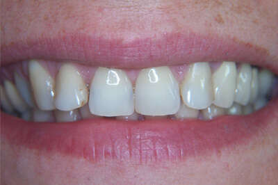 Cas du mois de Janvier 2016