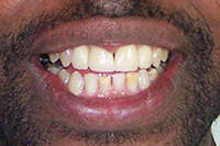 Cas du mois de novembre 2015