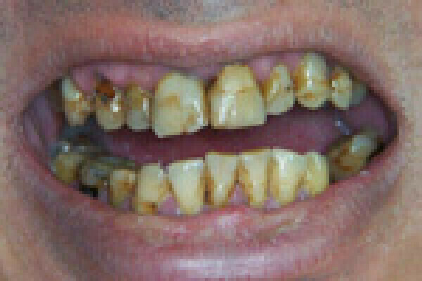 Cas le plus spectaculaire !!!!