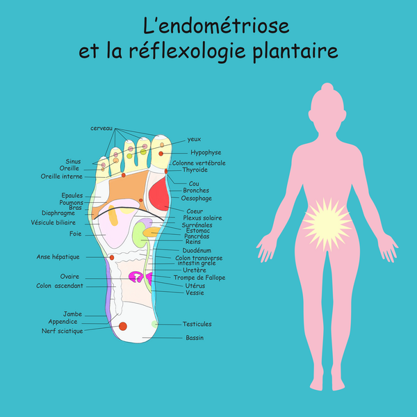 La réflexologie et l'endométriose