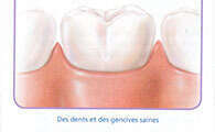 Pourquoi est-il important de consulter régulièrement votre dentiste ?