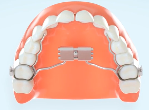 Informations sur le disjoncteur