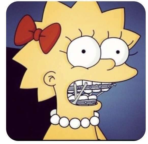 Un traitement d’orthodontie : comment ça se passe ? Point de départ