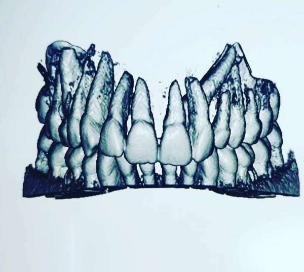 Pourquoi faire un traitement orthodontique ?