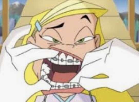 Les petits désagréments des bagues Orthodontiques