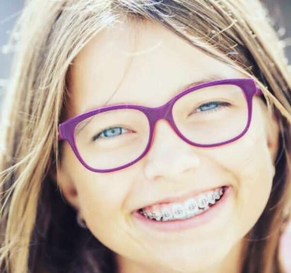 Quels sont Les différents types d’appareils orthodontique ?