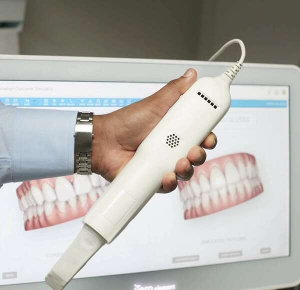 Le début de traitement comment cela se passe ? Le jour de la pose d’un appareil Orthodontique