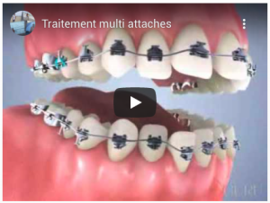 Traitement multi attaches