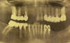 Paro-2