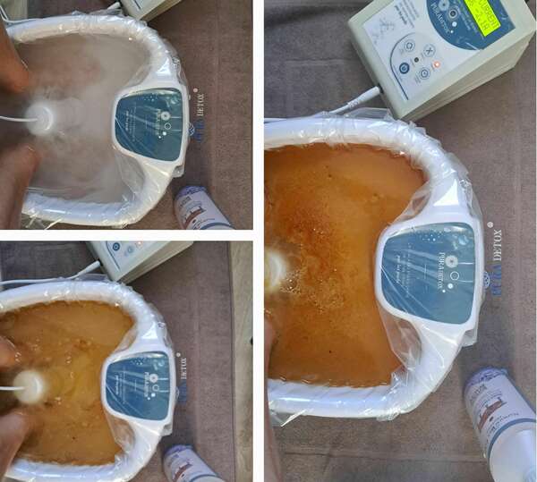 La Thalasso énergisante par les pieds