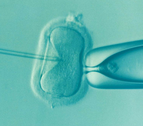 Le processus de la FIV : un chemin d’espoir et de résilience