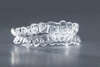 Orthodontie invisible - Dr Fateh ALCHALABI orthodontiste à Élancourt