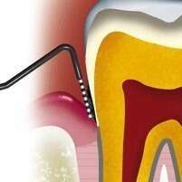 Evaluation de l’atteinte