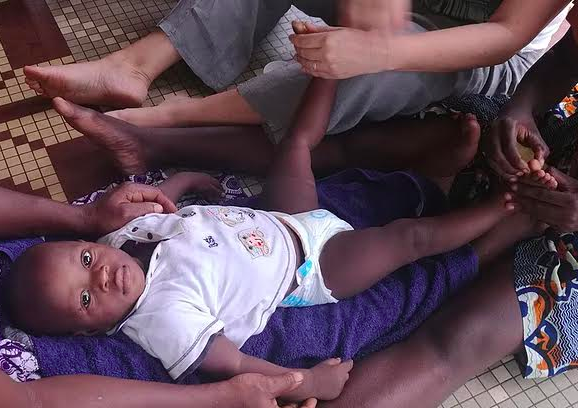 Mon séjour au Bénin - Réflexologie Humanitaire