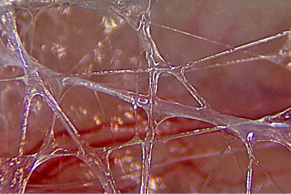 Les fascias : qu’est-ce que la fasciathérapie ?