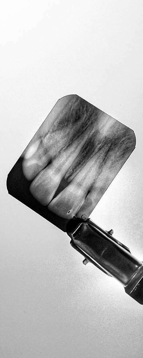 foto120250207-2605833-etc2yv