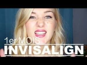 INVISALIGN ET ITERO DENTAL SCAN