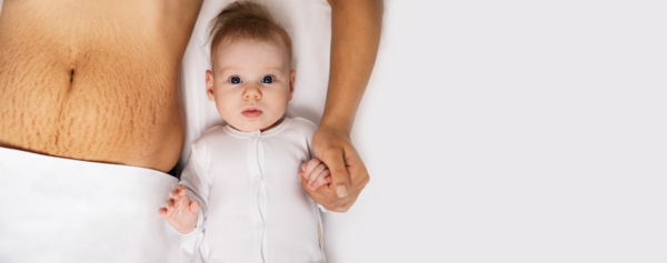 Vergetures : Comprendre, Prévenir et Traiter Naturellement