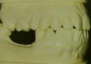 LES CONSULTATIONS PRÉ-OPÉRATOIRES