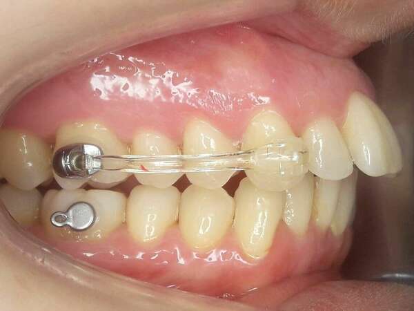 Le Motion Esthétique