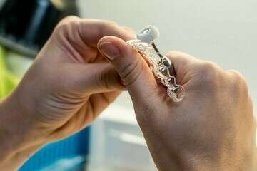 LA TECHNIQUE INVISALIGN® À LYON 4
