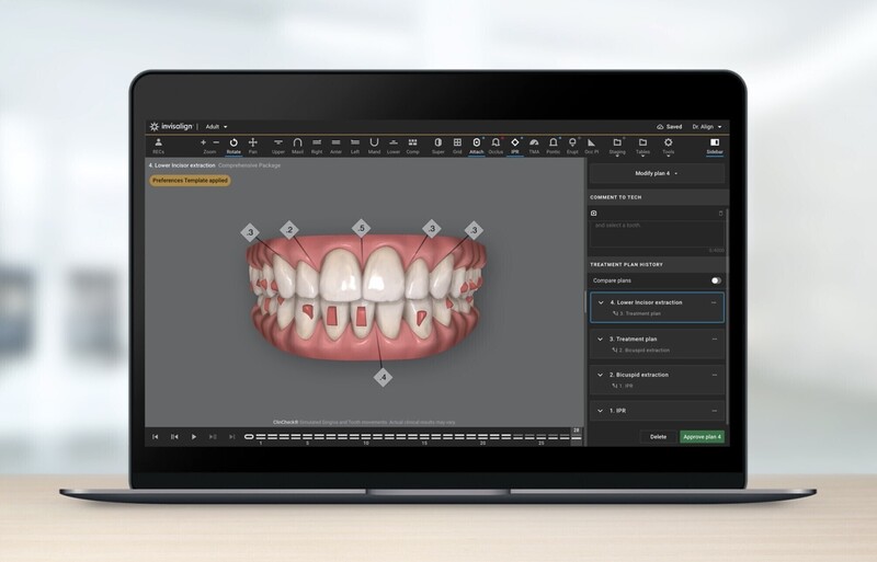 Logiciel ClinCheck orthodontie, Dr Eleonore Bonnel, Orchies