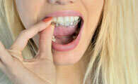 ORTHODONTIE INVISIBLE : LE TRAITEMENT PAR GOUTTIERES