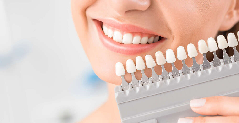 Facettes dentaires : sublimer votre sourire sans chirurgie ni douleur - Dr Frédéric Ouazan