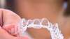 Traitement orthodontique par aligneur transparent