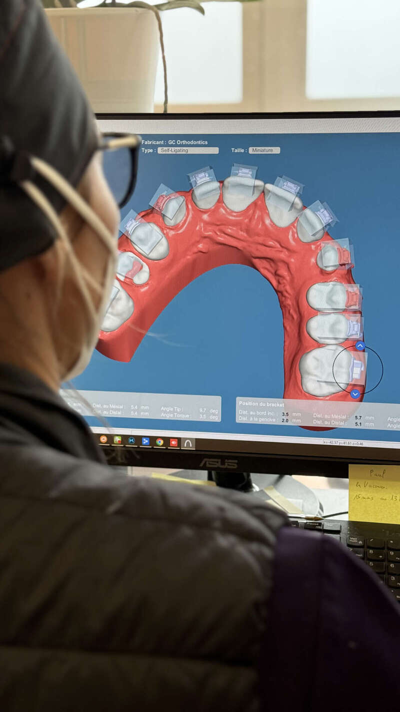 orthodontie_3d.jpeg