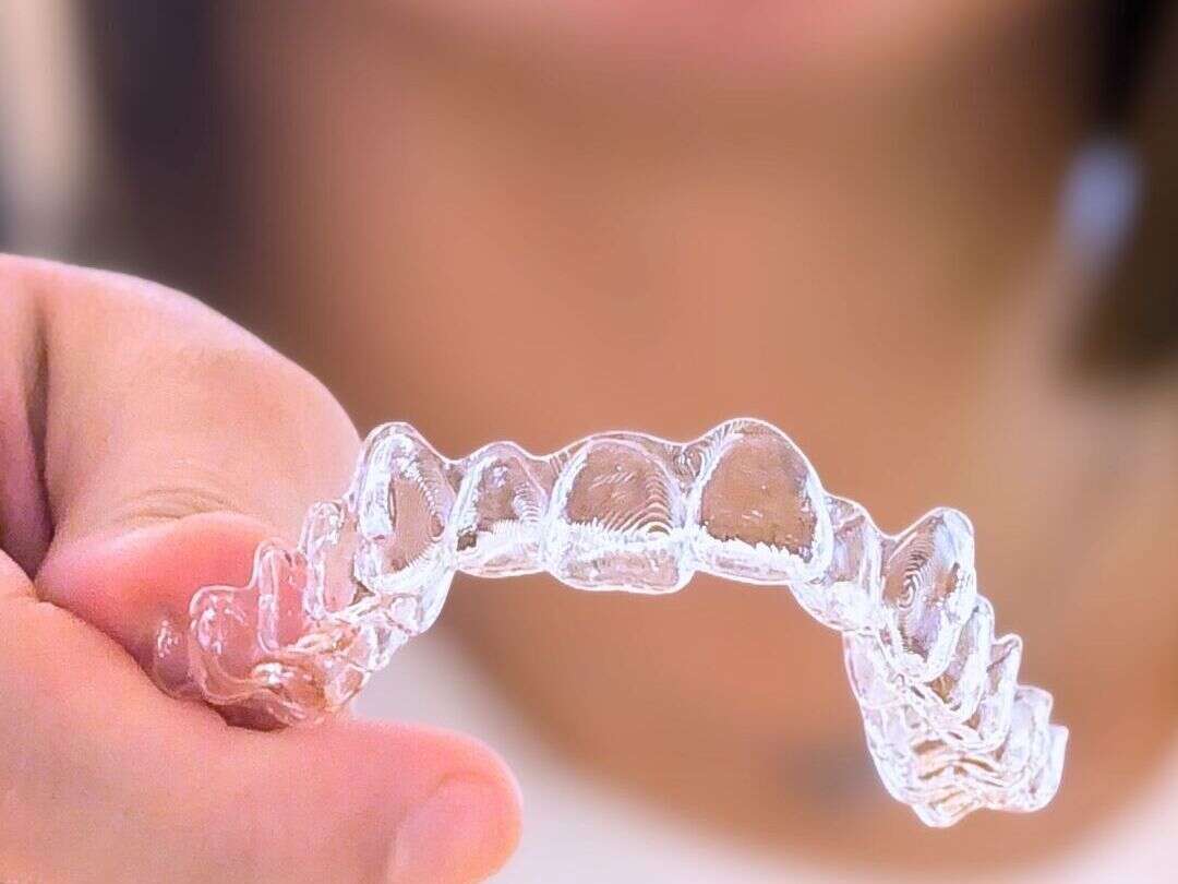 Aligneur transparent fabriqué au cabinet d'orthodontie grâce à notre laboratoire interne.