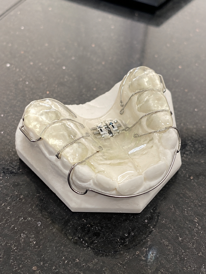 appareil_dentaire_orthodontie_enfant_chalon