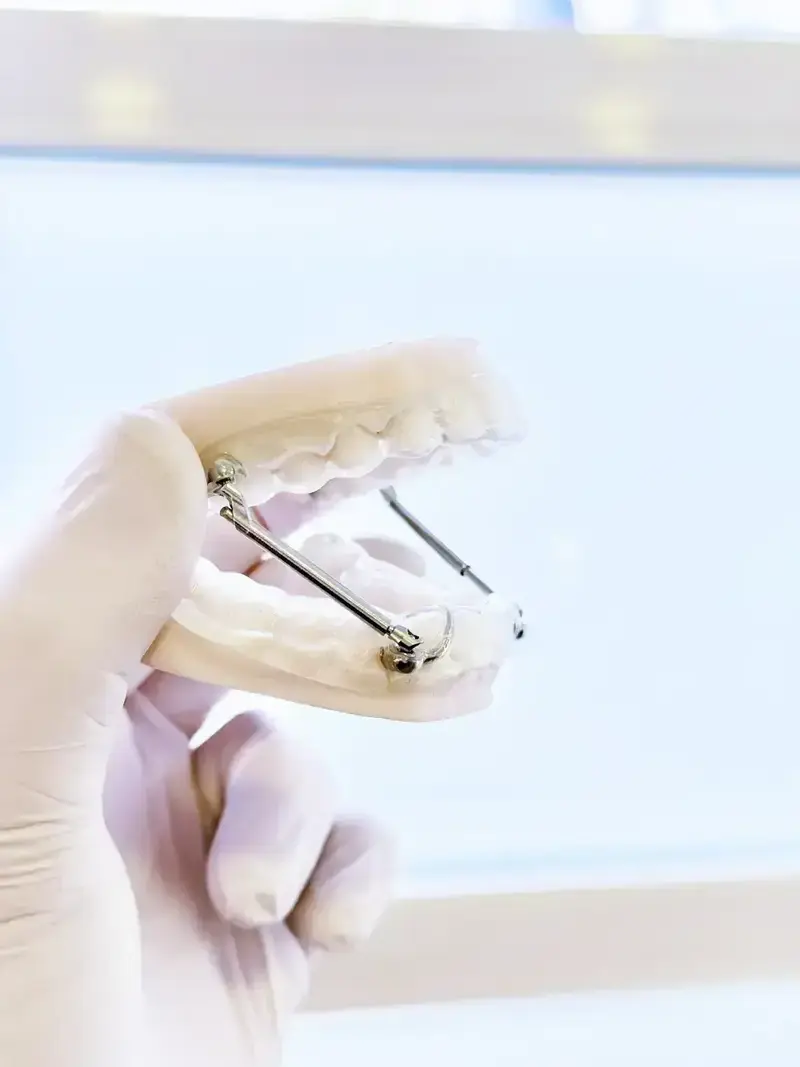 appareil_orthodontie