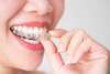 femme en traitement d'orthodontie adulte mettant une gouttière transparente