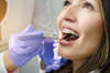 pose de bagues pour orthodontie adulte