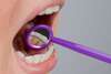 fil de contention posé en bouche dans un cabinet d'orthodontie